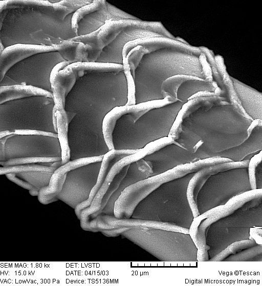 microscope-human-hair-structure-b_zpsnme083pv.jpg