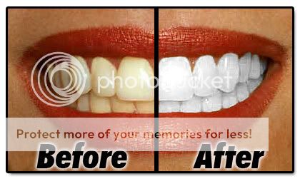 NEW 2 x CREST INTENSIVE PROFESSIONAL PRO EFFECTS 2 HOUR WHITESTRIPS 